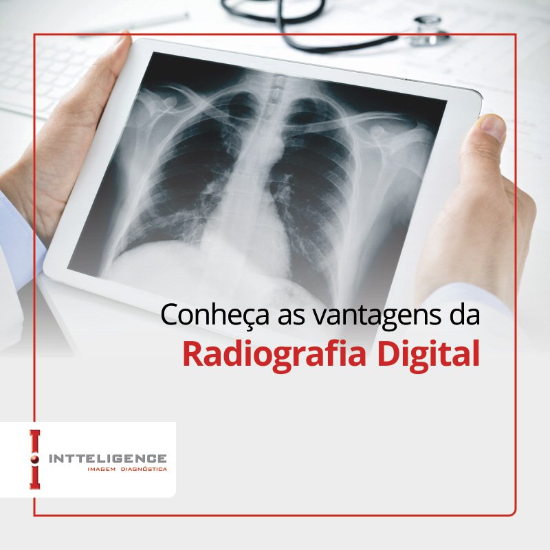 Conheça As Vantagens Da Radiografia Digital Notícias Intteligence Imagem Diagnóstica 4664